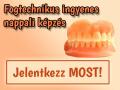 Fogtechnikus ingyenes képzés , ingyenesokjkepzesek@gmail.com , 